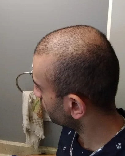 Before